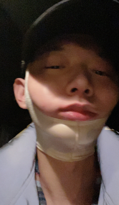 男星霍尊打哈欠导致下巴脱臼 半夜挂急诊痛得直飙眼泪