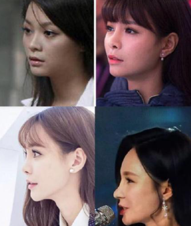 沈梦辰前后对比照 沈梦辰“变脸”后撞脸多个女星