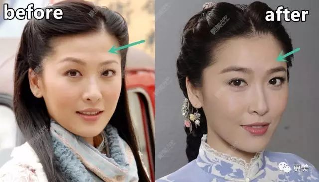 插足婚姻逼走原配 周丽淇宣布怀孕还被骂 41岁却像喝了冻龄水