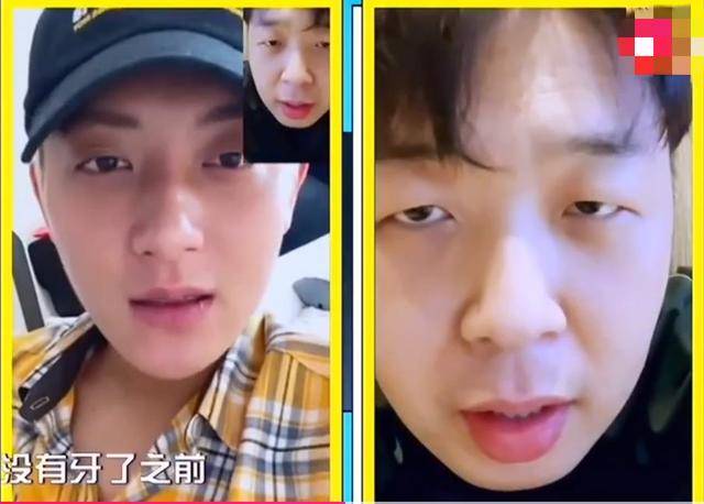 黄子韬吃娃娃菜把牙吃断 对比下掉牙前后照太好玩了