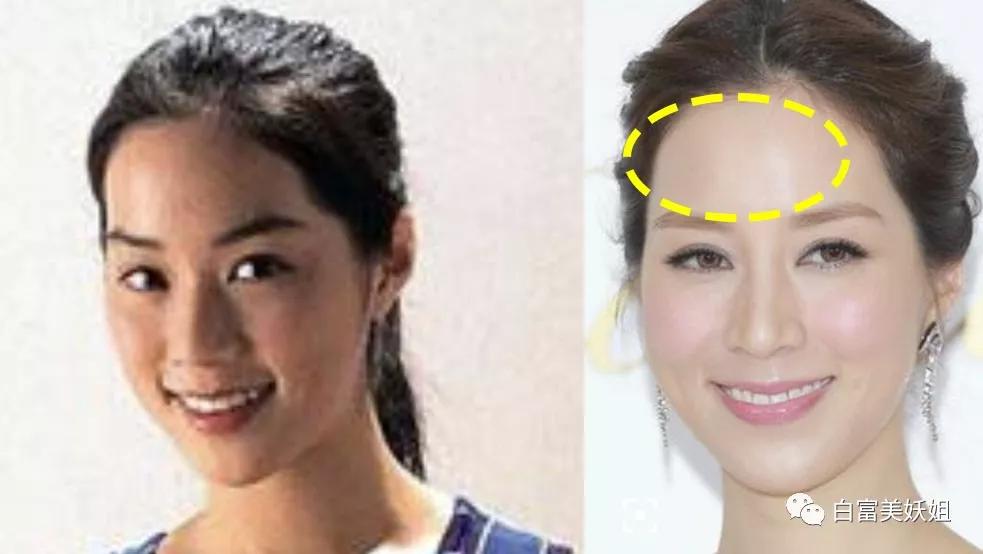 所有豪门阔太都是“郭式旺夫脸” 百年一遇面相到底啥样