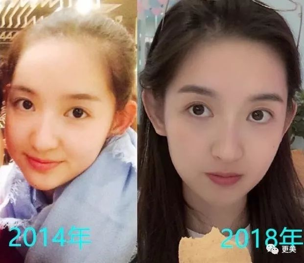肖战的荧幕初吻23岁的王玉雯 抛弃导演男友说林更新黄晓明丑