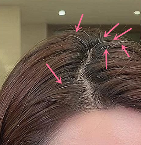 蒋凡张大奕事件结果是什么 女方才32岁已经有白头发