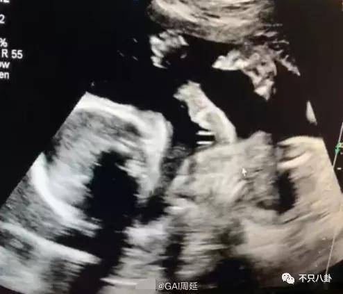 gai的老婆王斯然是哪里人 太宠了这狗粮嗑到吐血