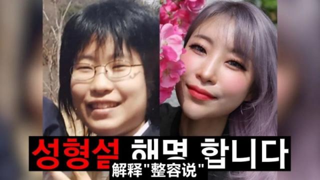 性骚扰男爱豆风波后她又陷整容争议 参加节目被指洗白