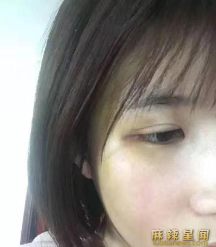 许凯家暴女朋友是真的吗 网友:谁家暴谁