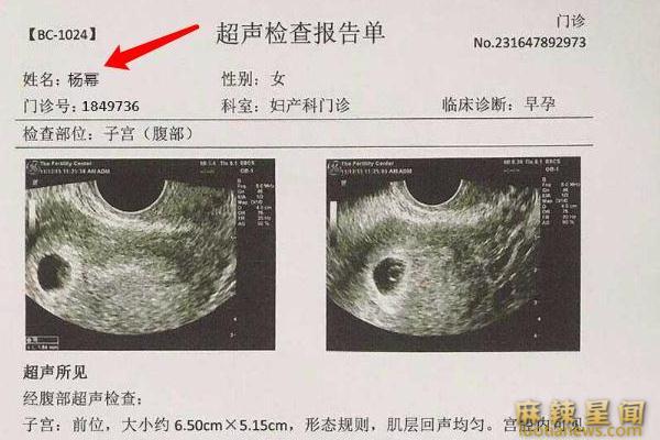 杨幂凌晨公布二胎喜讯 前夫沉默回应二人有望复婚