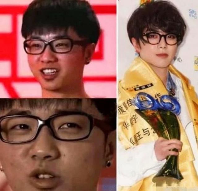 华晨宇承认整容是真的吗 鼻子变窄脸型成锥子脸