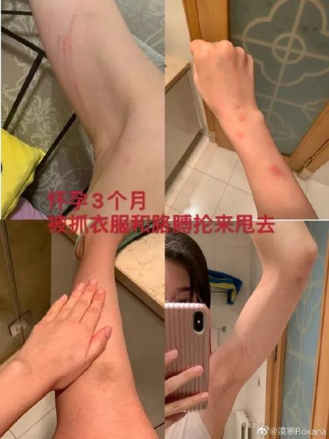张培萌家暴事件反转了 抵制家暴从我做起