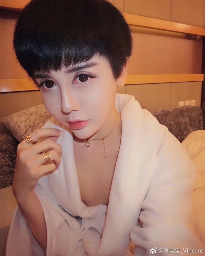 刘梓晨取出玻尿酸后的照片,刘梓晨整容前是什么样?