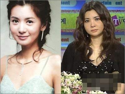 韩国公认10大整容美女名单,韩国美女整容前后对比