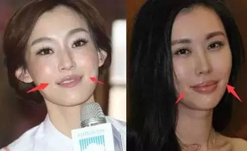 微整老了以后真可怕图片,整容医生都不整容是真的吗?