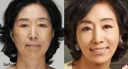 女性法令纹深面相图解,法令纹深代表什么