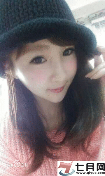 沈玉琳的眼睛怎么了?沈玉琳老婆牙牙资料照片