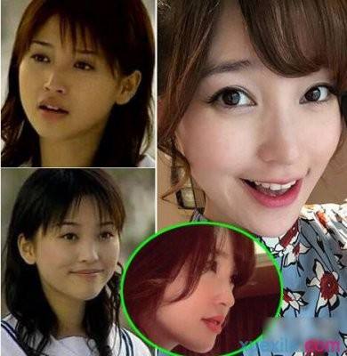 为什么大家都讨厌金莎?金莎整容前后照片