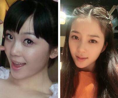 赵韩樱子整容前后照片,赵韩樱子整容失败后太可惜了