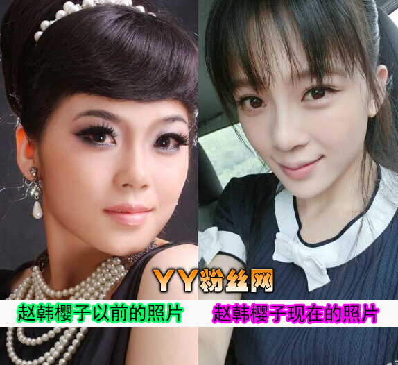 赵韩樱子整容前后照片,赵韩樱子整容失败后太可惜了
