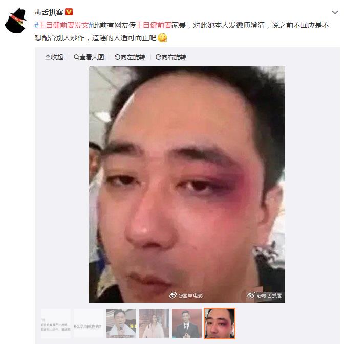 ���Խ������Ŵ������������ǰ����ѧɢ�����ļٵ�
