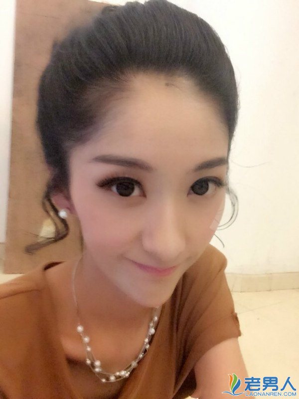 王晰老婆金宴竹资料照片,王晰为什么没有走红?