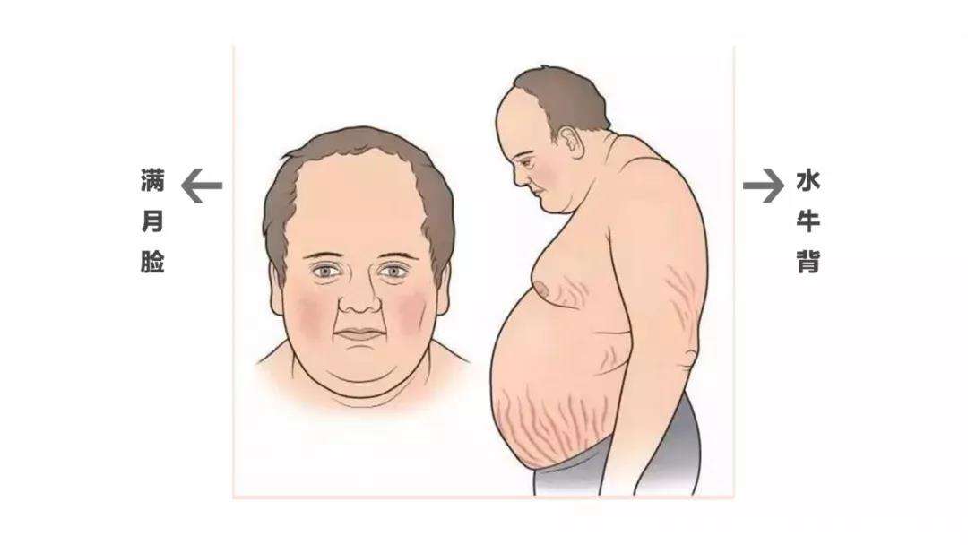 ������ˮţ����ͼƬ����������ʲô�����µģ�