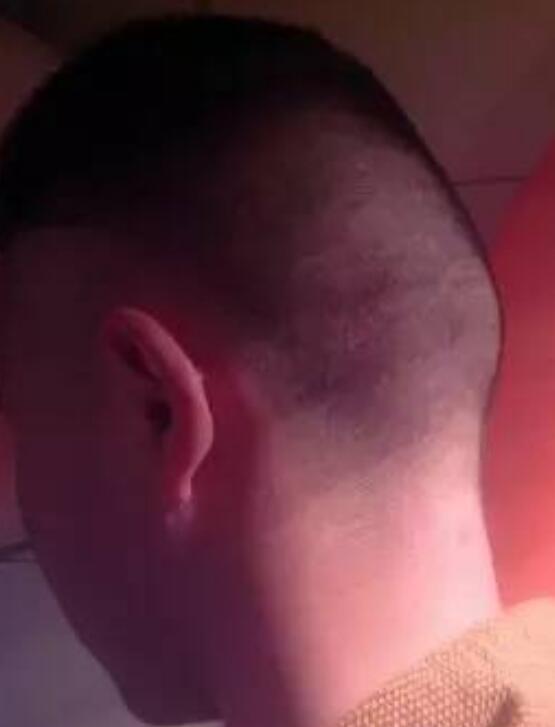 怎么看脑袋有没有反骨?男人有反骨有什么说法