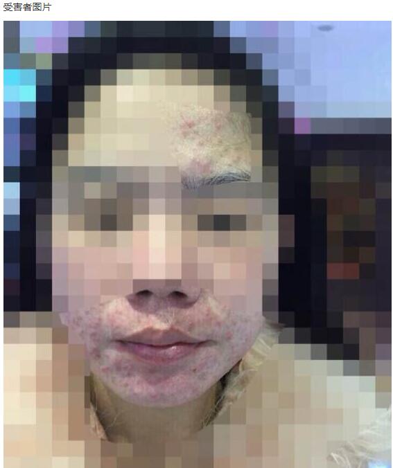 周梦晗卖假面膜后逃到哪里了,周梦晗面膜长毛