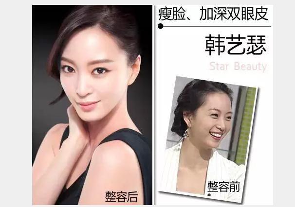 韩艺瑟整容前后对比图变化惊人,韩艺瑟韩国人气如何家里很有钱吗?