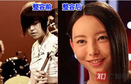 于文文上中国好歌曲是哪一期?于文文整容前后对比图
