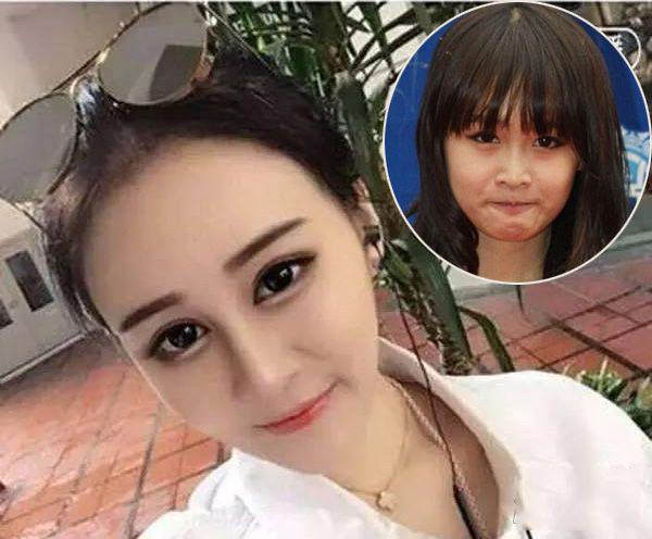 赵本山女儿赵一涵d罩杯胸部图,赵一涵有没有整容前后对比好吓人