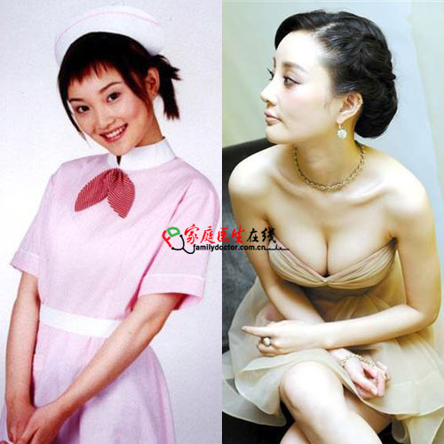 李小璐是怎样丰胸的?李小璐为什么没有上过大学