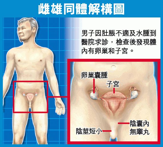 男子发现自己来月经是女儿身,双性人下体到底是什么样?