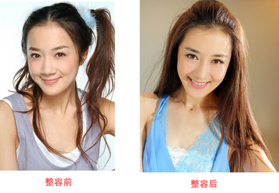 李依晓整容前后对比图,李依晓的胸围有多大?