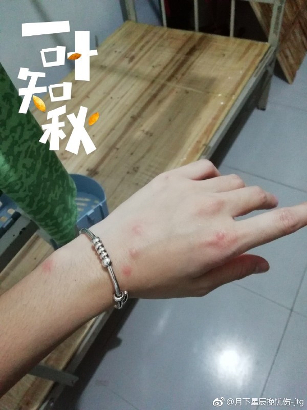 ����ҧ�İ���ɶ���ӣ�������ôԤ������ҧ��