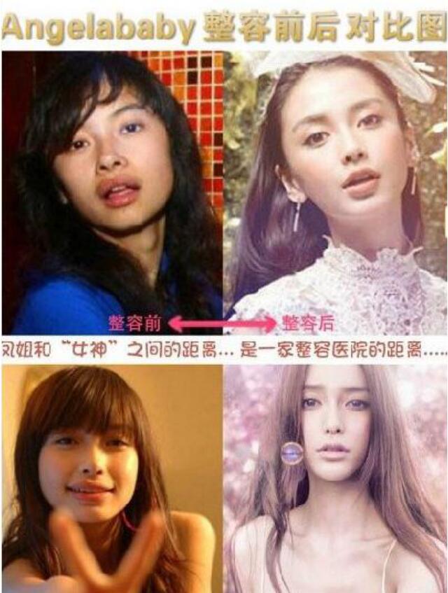 凤姐为什么整不成angelababy,凤姐长得像angelababy对比图
