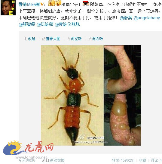 隐翅虫咬人后的图片,隐翅虫的天敌克星是什么?