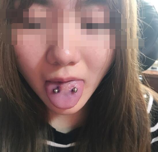 ��ͷ�ϴ��ඤ��ʲô�ã�����Ӱ�쵽�Է���