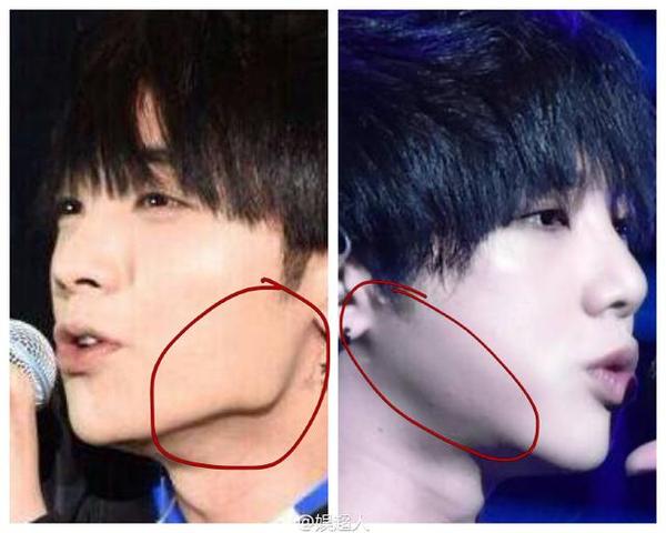 华晨宇整容前后对比照片,华晨宇为什么叫火星人?