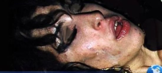 艾米怀恩豪斯烂脸的图片,她死后老公现状如何?