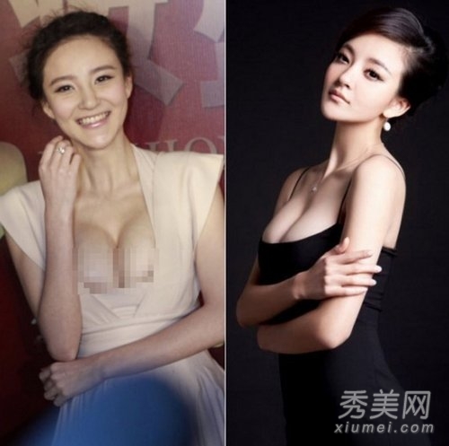 杨幂柳岩刘雨欣 G奶女星真假胸器PK