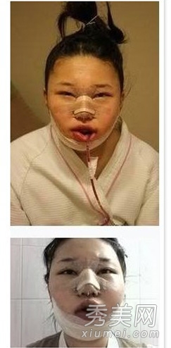 ʵ�ģ�����Ů�����ݹ��� ���ǳ�̫֬�ֲ�