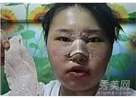 ʵ�ģ�����Ů�����ݹ��� ���ǳ�̫֬�ֲ�