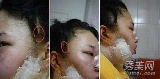 ʵ�ģ�����Ů�����ݹ��� ���ǳ�̫֬�ֲ�