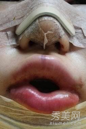 ʵ�ģ�����Ů�����ݹ��� ���ǳ�̫֬�ֲ�