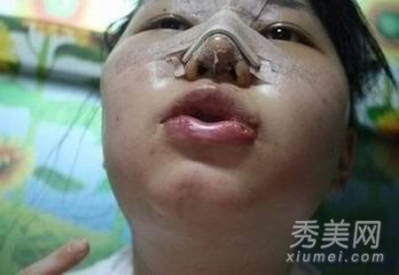 ʵ�ģ�����Ů�����ݹ��� ���ǳ�̫֬�ֲ�