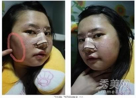 ʵ�ģ�����Ů�����ݹ��� ���ǳ�̫֬�ֲ�