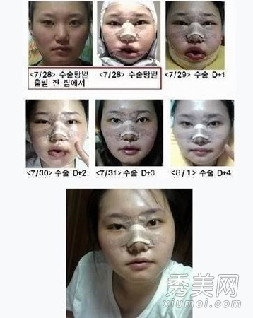 ʵ�ģ�����Ů�����ݹ��� ���ǳ�̫֬�ֲ�