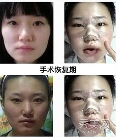 ʵ�ģ�����Ů�����ݹ��� ���ǳ�̫֬�ֲ�