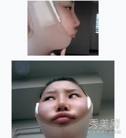 ʵ�ģ�����Ů�����ݹ��� ���ǳ�̫֬�ֲ�