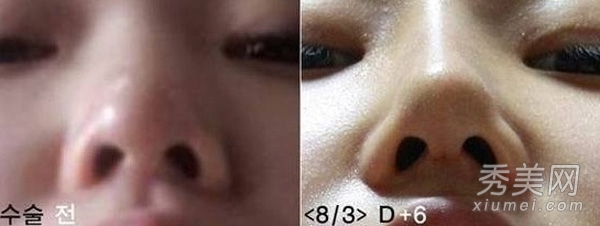 ʵ�ģ�����Ů�����ݹ��� ���ǳ�̫֬�ֲ�