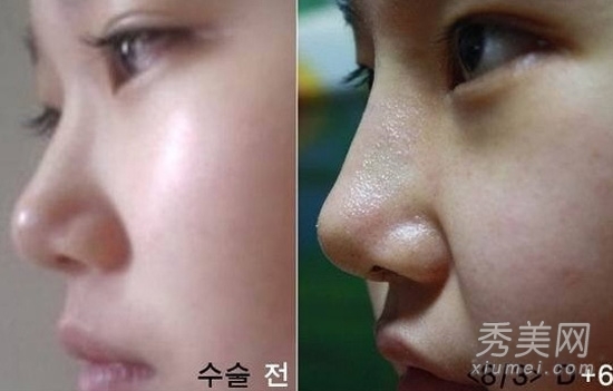 ʵ�ģ�����Ů�����ݹ��� ���ǳ�̫֬�ֲ�